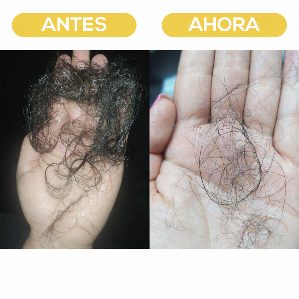 Tónico Anticaída