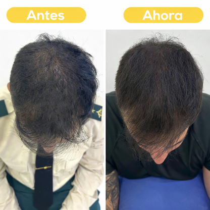 Tónico Anticaída